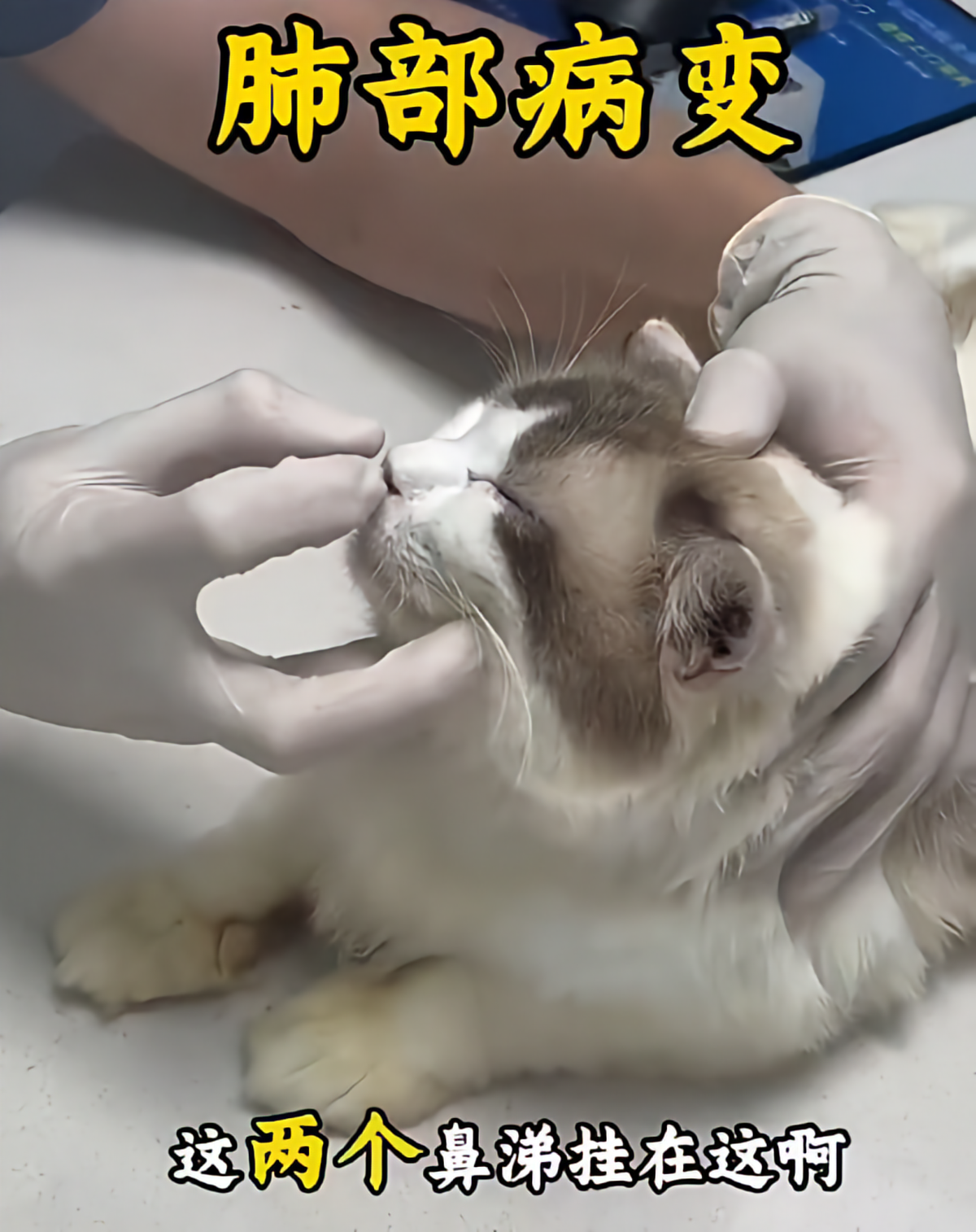 肺部护理前